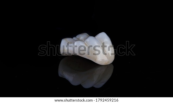 dental inlay made of\
ceramic with morphology on the chewing tooth, filmed on black glass\
with reflection