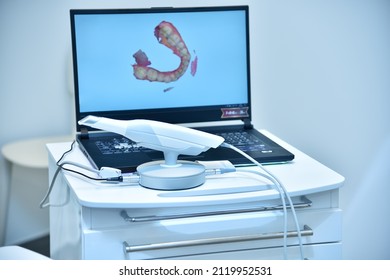 Dental intraoral 3d scanner and laptop on table in dentist office. Dentistry and health care concept. Close up