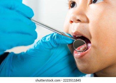 Dental kid health examination. Asian dentist making examination procedure for cute little girl open mouth, Doctor examines oral cavity of little child uses mouth mirror to checking teeth cavity - Powered by Shutterstock