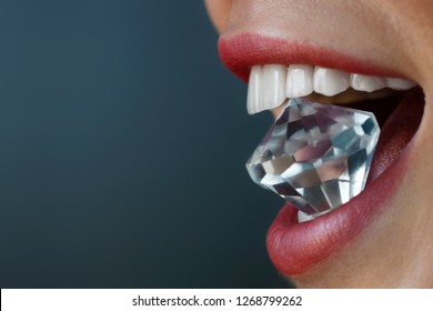 dental laminate veneers. smile design.