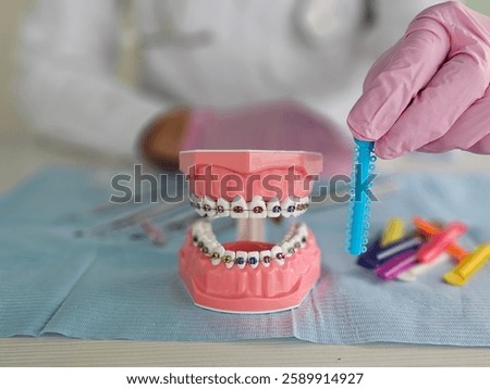 Dental model demonstrating braces application and color selection in a clinic setting
