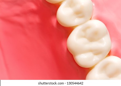 Dental Model Of Molar Tooth