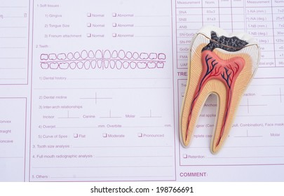 Dental Model On Chart