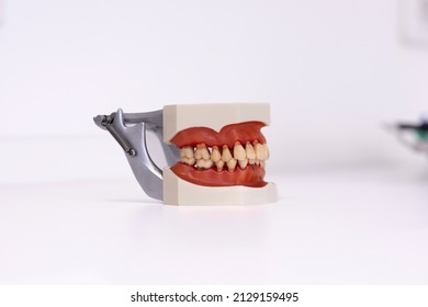 1,469 Dental Moulding Images, Stock Photos & Vectors 