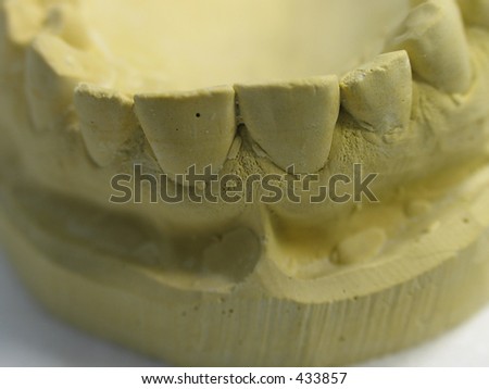 Dental mold
