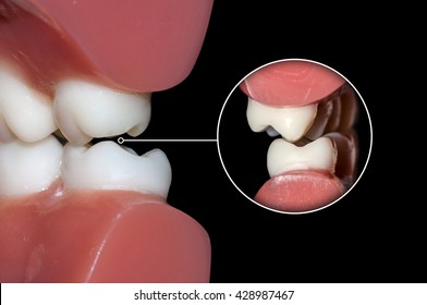 dental occlusion molars teeth close up