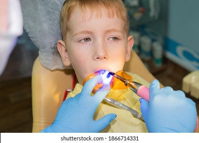 Dental Office. A 7-year-old Child Is Fitted With A Dental Seal On The Lower Jaw Bast. Irradiate With Ultraviolet Light For Solidification