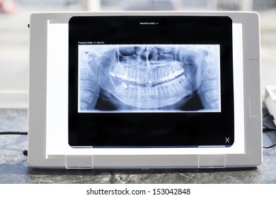 Dental Panoramic Xray Viewer Reflection Stock Photo Edit Now