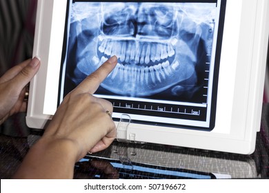 X Ray Film Viewer Images Stock Photos Vectors Shutterstock