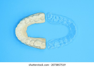 Dental Plaster Mold And Orthodontic Silicone Trainer. Mobile Orthodontic Appliance For Dental Correction, On Blue Background.