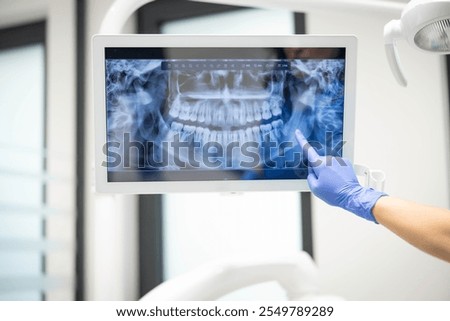 A dental professional wearing gloves points to a dental X-ray displayed on a monitor, highlighting details of a patient's teeth for review or diagnosis.