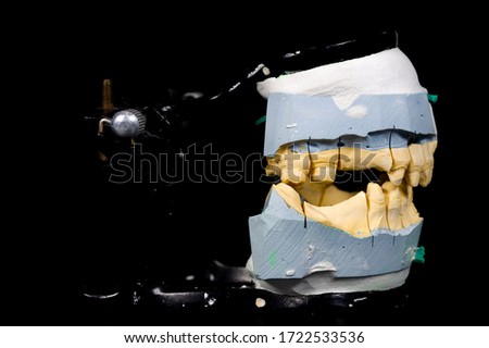dental prosthesis at the dentist with teeth and masses prepared for clients