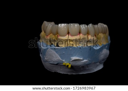 dental prosthesis in the dentist's office with teeth and masses