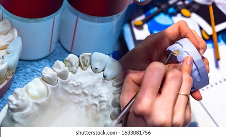 Dental prosthetics services. The manufacture of dental prostheses. Dental technician at work. Training to become a dentist. Professional development of dentists.