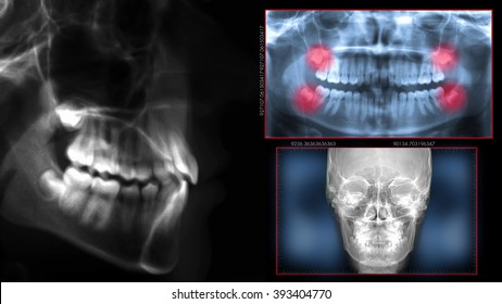 Dental Scan, Radiography