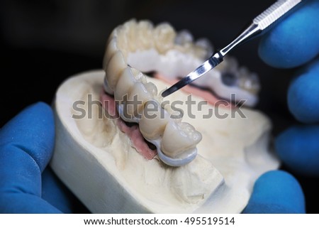 Dental technician applied glaze on ceramic crown