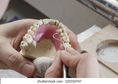 Dental Technician Doing Partial Dentures Of Acrylic Resins In The Lab.