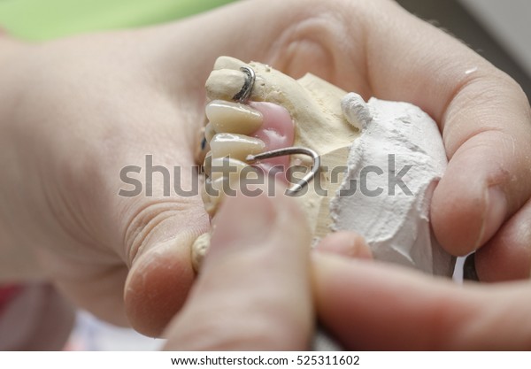 Dental technician doing partial dentures of acrylic\
resins in the lab.