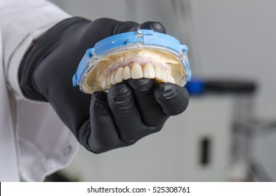 Dental technician holding a monolithic zirconia restorations full arch implant  supported with the ceramic load in vestibular.