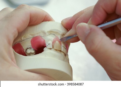 Dental Technician Making New Dentures With Plaster Model