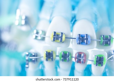Dental teeth retainers metal aligners brackets to straighten teeth in orthodontic dentistry treatments.