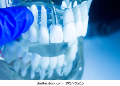 Zahnzahnzahnarztlehrmodell für Zahnzahnarzt mit Zahnfleisch.