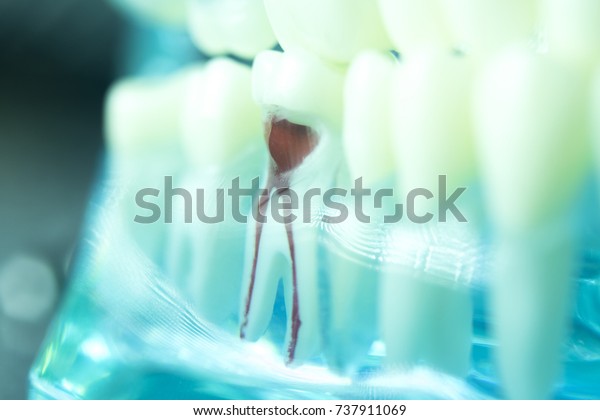 Dental\
tooth root canal dentists teeth model\
closeup.