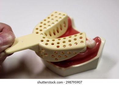 Dental Tray
