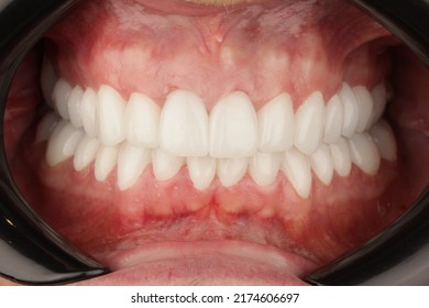 Dental Treatment of a patient in dental clinic - Shutterstock ID 2174606697