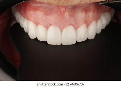 Dental Treatment of a patient in dental clinic
