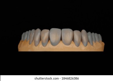 830 Dental wax up Images, Stock Photos & Vectors | Shutterstock