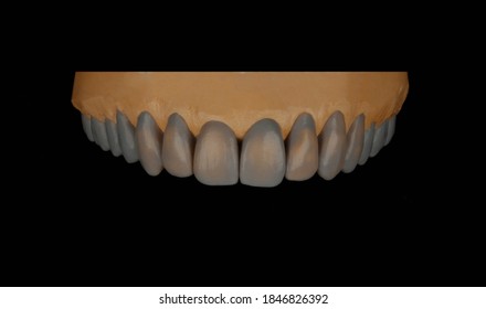 830 Dental wax up Images, Stock Photos & Vectors | Shutterstock