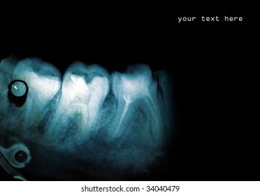 Dental Xray Background