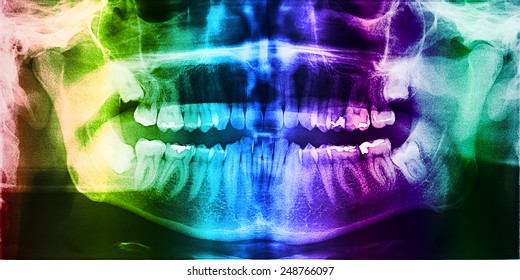 Dental X-Ray Photo Of Human Skull With Teeth