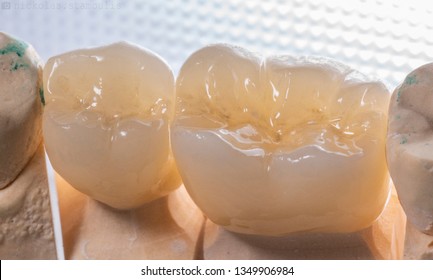 Dental Zirconia crown