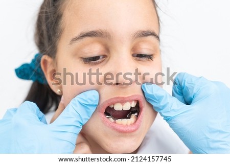 Dentist is check and set dimension of brackets. Talking to girl about braces in her mouth