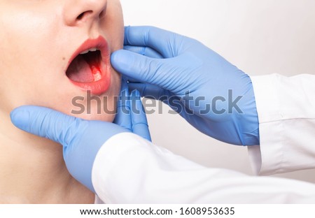 Dentist doctor examines the bite of the jaw of a girl and a bad tooth with pulpitis, gum disease, close-up, fluorosis