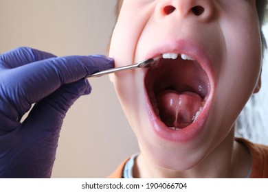 dentist, doctor examines oral cavity of small patient, length of frenum, boy, kid performs articulation exercises for mouth, concept of speech disorders, correction, selective focus on bridle of tongu