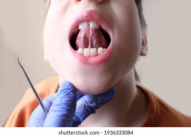 dentist, doctor examines oral cavity of small patient, length of frenum of the tongue, boy, kid performs articulation exercises for mouth, concept of speech disorders, correction