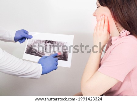 A dentist doctor is holding a panoramic X-ray picture of a female patient who has an inflamed dental cyst, a neoplasm. Removal of a dental cyst, malignant tumor