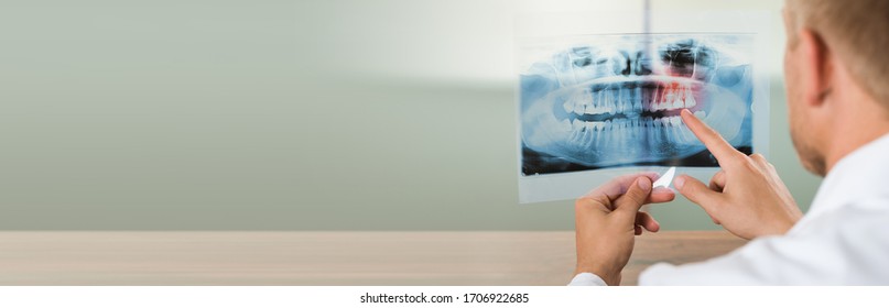 Dentist Doctor Looking At Jaw Tooth Dental Xray