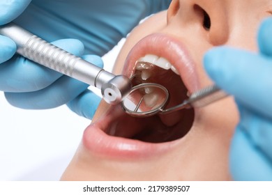 A dentist doctor treats caries on a tooth of a young beautiful woman in a dental clinic. Tooth filling. - Powered by Shutterstock