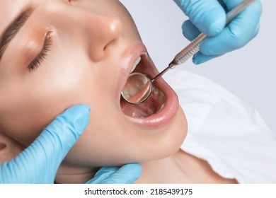 A dentist doctor treats caries on a tooth of a young beautiful woman in a dental clinic. Tooth filling.