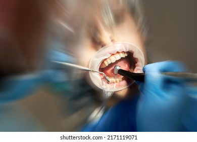 Dentist Drilling Tooth To Male Patient In Dental Chair With Motion Blur Effect