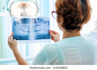 A dentist examines orthopantomogram in her hands