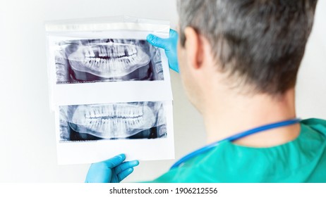 The dentist examines a panoramic X-ray image of the teeth of the upper and lower jaws. Preparation for dental implantation. The visceral surgeon makes a diagnosis before the bone augmentation surgery.