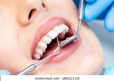 dentist examines the patients teeth at the dentist. close up - Powered by Shutterstock