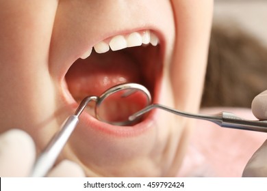 Dentist Examining Girl's Teeth, Close Up