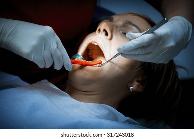 Dentist Examining A Patients Teeth Before Oral Surgery At The Dental Clinic. Removing Amalgam Fillings. Professional Care Of Patient Teeth.