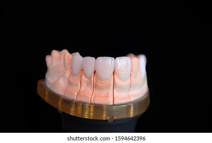 Dentist Fixed Missing Teeth Patient Stock Photo 1594642396 | Shutterstock